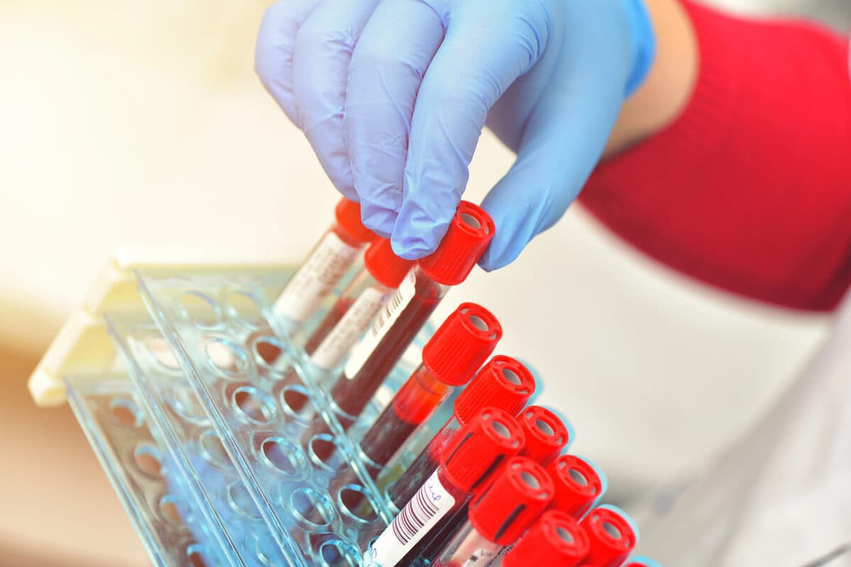 Redirect Your Health Path with Lab Tests at iMed Urgent Care!